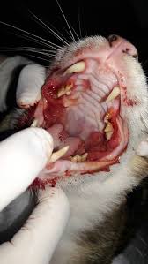 Stomatitis
