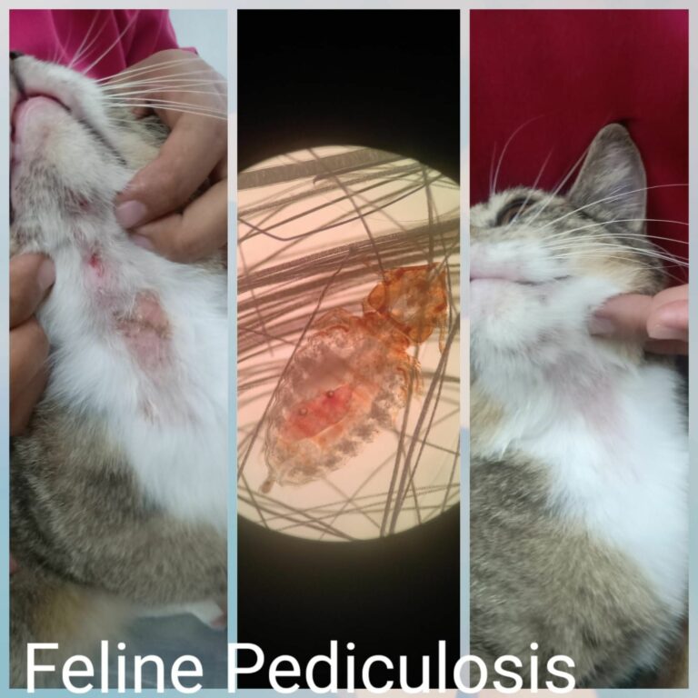 Pediculosis